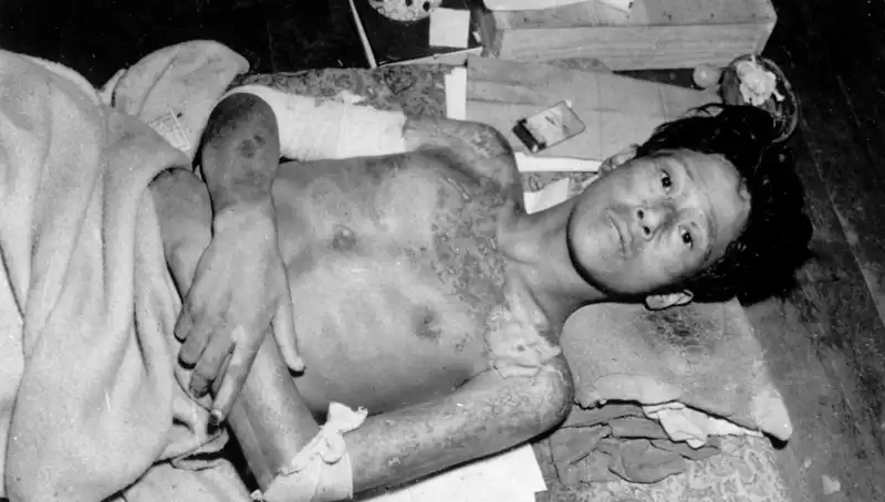 Nagasaki’nin 80. Yılındaki Acı Hatırlatması: Nükleer Tehdit Yeniden Gündemde